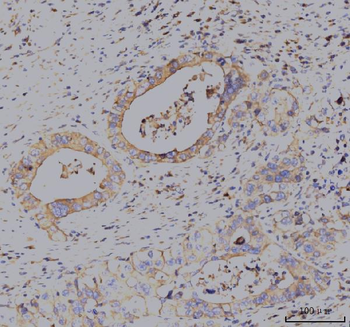 KCNQ1 Rabbit Polyclonal Antibody