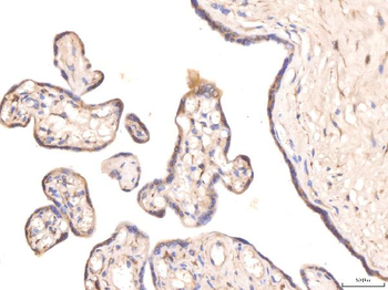 KCNQ1 Rabbit Polyclonal Antibody