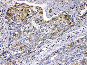 Cytokeratin 14/KRT14 Rabbit Polyclonal Antibody