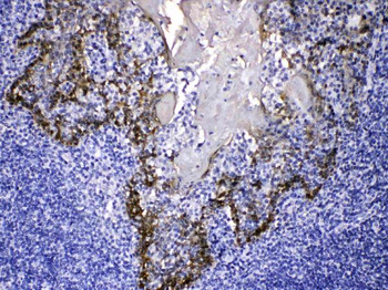 Cytokeratin 14/KRT14 Rabbit Polyclonal Antibody