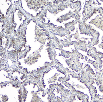 Mannose Phosphate Isomerase/MPI Rabbit Polyclonal Antibody