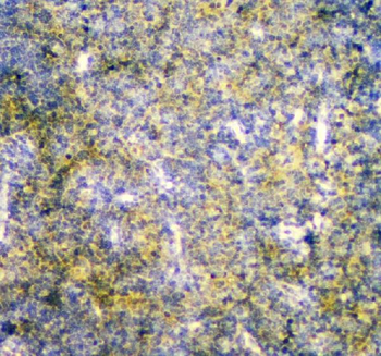Mannose Phosphate Isomerase/MPI Rabbit Polyclonal Antibody
