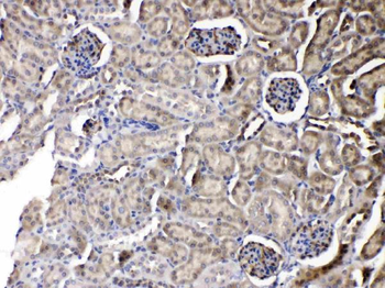 Nucleoside phosphorylase/PNP Rabbit Polyclonal Antibody