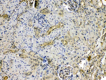 Nucleoside phosphorylase/PNP Rabbit Polyclonal Antibody