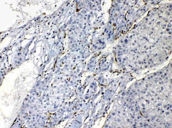 Nucleoside phosphorylase/PNP Rabbit Polyclonal Antibody