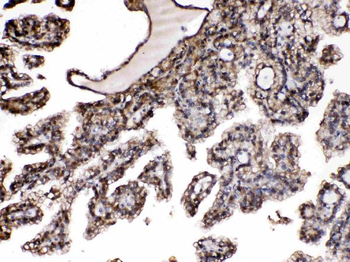 Nucleoside phosphorylase/PNP Rabbit Polyclonal Antibody