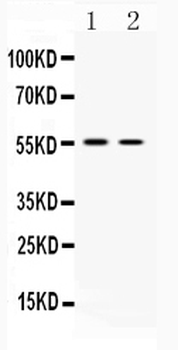 Vesicular Acetylcholine Transporter/SLC18A3 Rabbit Polyclonal Antibody
