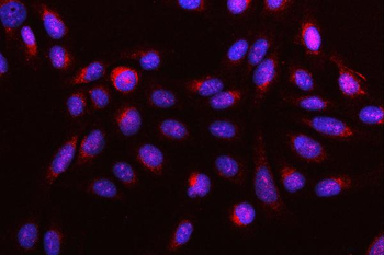 DR4/TNFRSF10A Rabbit Polyclonal Antibody