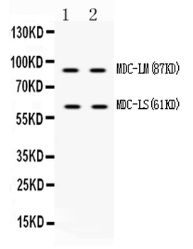 ADAM28 Rabbit Polyclonal Antibody