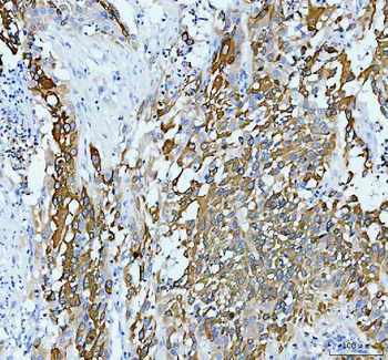 Anterior Gradient 2/AGR2 Rabbit Polyclonal Antibody