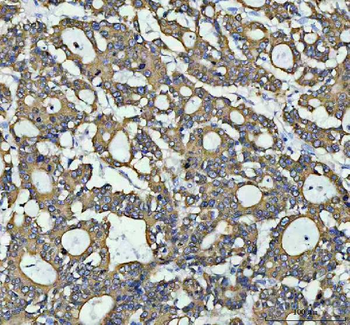 Anterior Gradient 2/AGR2 Rabbit Polyclonal Antibody