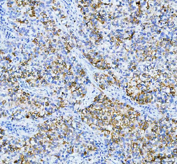 Anterior Gradient 2/AGR2 Rabbit Polyclonal Antibody