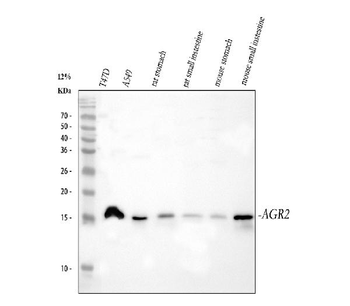 Anterior Gradient 2/AGR2 Rabbit Polyclonal Antibody