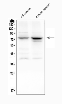 12 Lipoxygenase/ALOX12 Rabbit Polyclonal Antibody