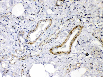 Angiopoietin-2/ANGPT2 Rabbit Polyclonal Antibody