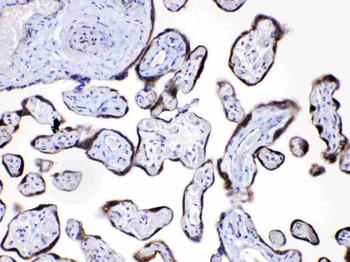 Angiopoietin-2/ANGPT2 Rabbit Polyclonal Antibody