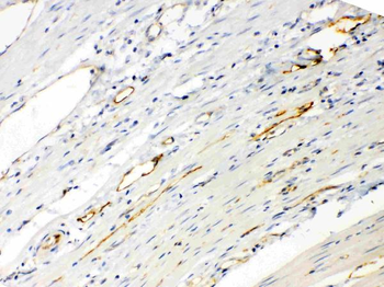 ANGPTL2 Rabbit Polyclonal Antibody