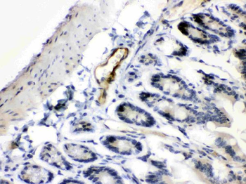 ANGPTL2 Rabbit Polyclonal Antibody