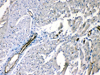 ANGPTL2 Rabbit Polyclonal Antibody