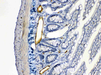 ANGPTL2 Rabbit Polyclonal Antibody