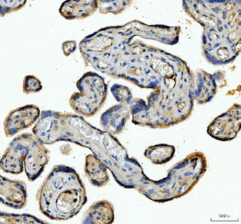 Angiopoietin-like 4/ANGPTL4 Rabbit Polyclonal Antibody