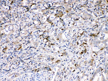 Bax Rabbit Polyclonal Antibody