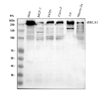 BRCA1 Rabbit Polyclonal Antibody