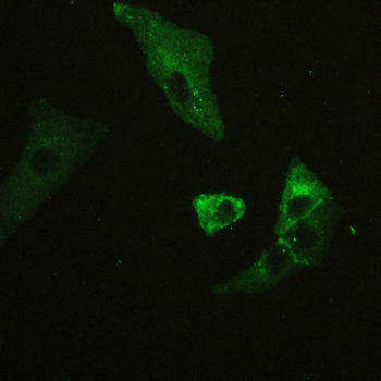 CD147/Emmprin/BSG Rabbit Polyclonal Antibody