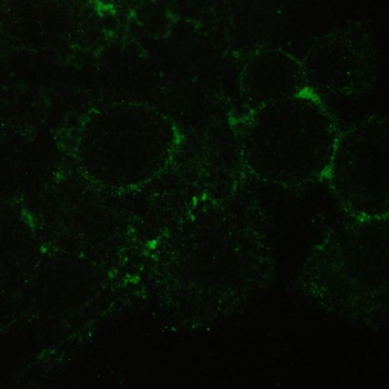 CD147/Emmprin/BSG Rabbit Polyclonal Antibody