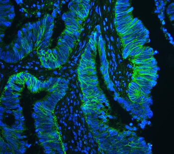 CD147/Emmprin/BSG Rabbit Polyclonal Antibody