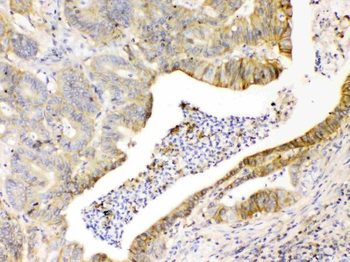 CD147/Emmprin/BSG Rabbit Polyclonal Antibody