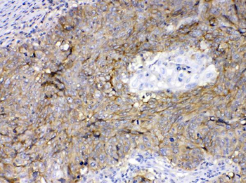CD147/Emmprin/BSG Rabbit Polyclonal Antibody