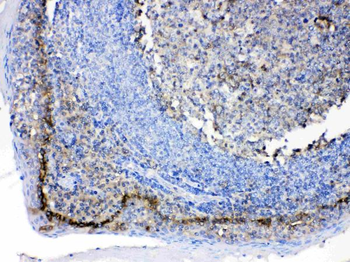 CD147/Emmprin/BSG Rabbit Polyclonal Antibody
