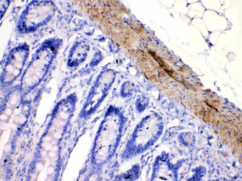 Nicotinic Acetylcholine Receptor alpha 5/CHRNA5 Rabbit Polyclonal Antibody