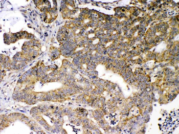 GAD65/GAD2 Rabbit Polyclonal Antibody