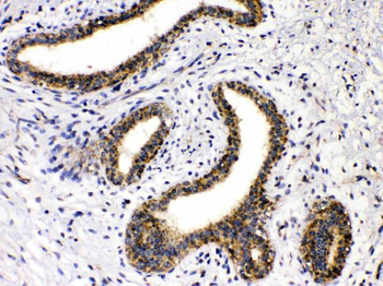 GAD65/GAD2 Rabbit Polyclonal Antibody