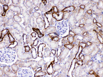 GAD65/GAD2 Rabbit Polyclonal Antibody
