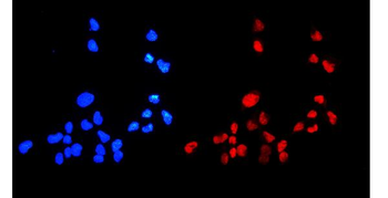HMGB1 Rabbit Polyclonal Antibody