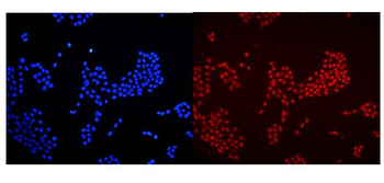 HMGB1 Rabbit Polyclonal Antibody