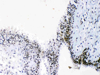 HMGB1 Rabbit Polyclonal Antibody