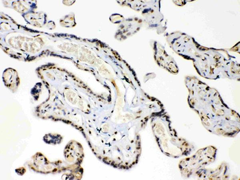HMGB1 Rabbit Polyclonal Antibody