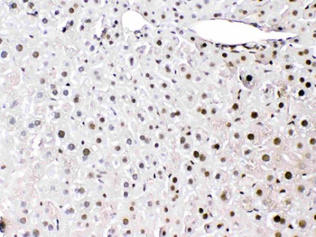 HMGB1 Rabbit Polyclonal Antibody