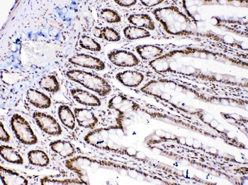 HMGB1 Rabbit Polyclonal Antibody