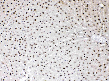 HMGB1 Rabbit Polyclonal Antibody