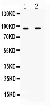 IFNGR1 Rabbit Polyclonal Antibody