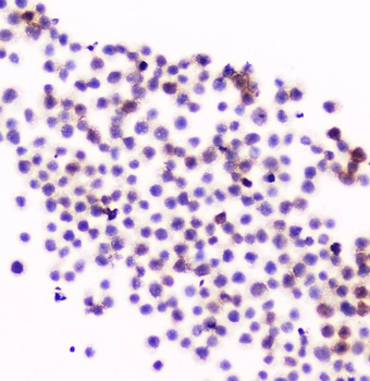CD11a/ITGAL Rabbit Polyclonal Antibody