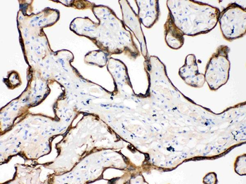 Cytokeratin 18/KRT18 Rabbit Polyclonal Antibody