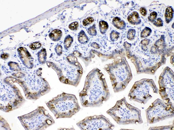 Cytokeratin 18/KRT18 Rabbit Polyclonal Antibody
