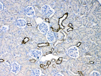 Cytokeratin 18/KRT18 Rabbit Polyclonal Antibody