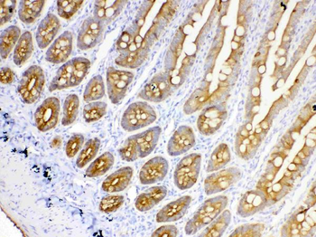 Cytokeratin 18/KRT18 Rabbit Polyclonal Antibody